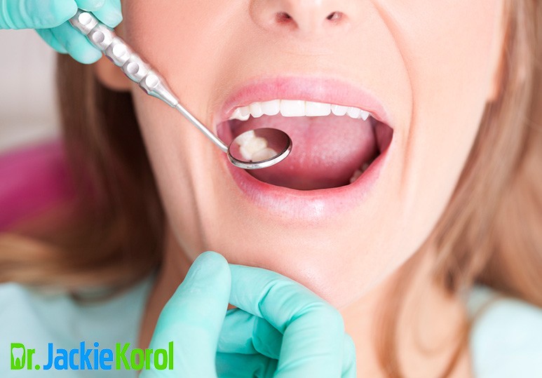 Everything You Need to Know About Dental Fillings 