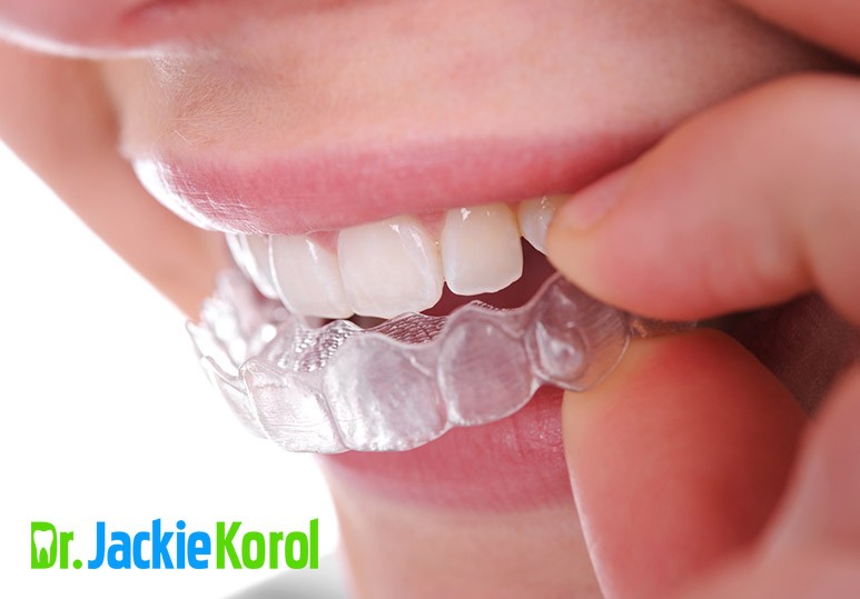 5 Ways to Get The Best Invisalign Results 