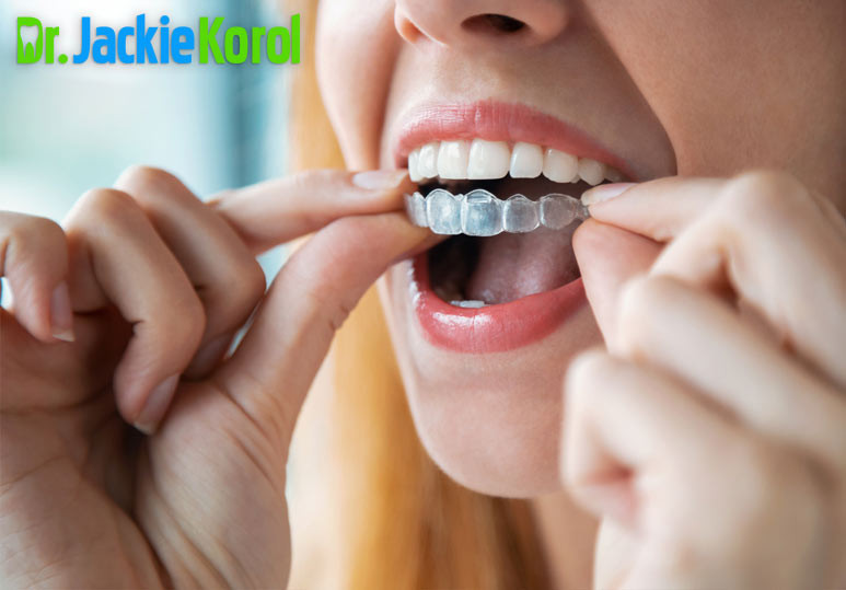 Which Is Better? Invisalign Or Braces?