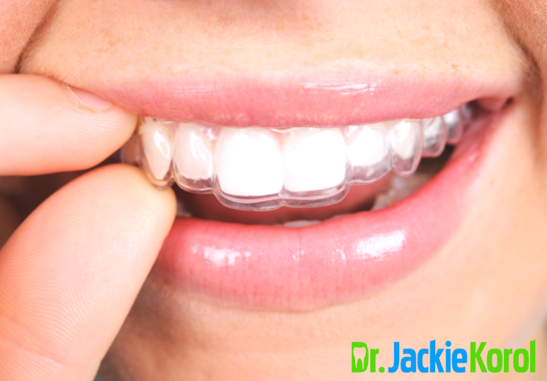 3 Tips For Looking After Your Invisalign Braces 