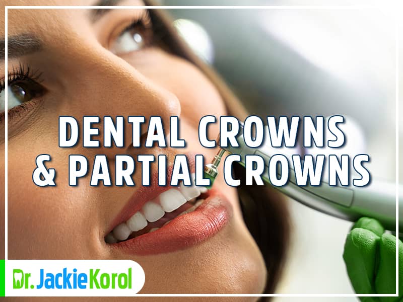 Dental Crowns and Partial Crowns