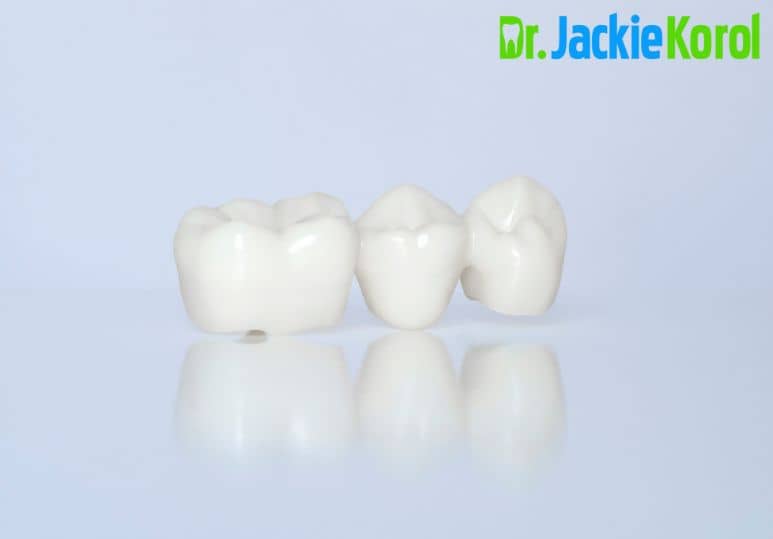 Ceramic Dentistry: The Difference Between Inlays And Onlays