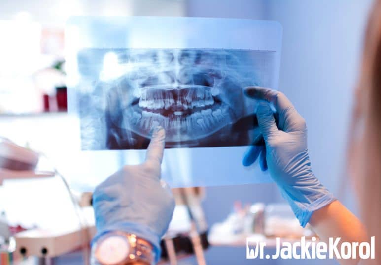 Dental Exams: The Benefits Of Digital X-Rays