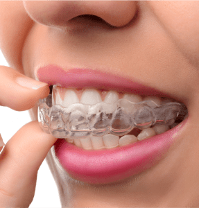 Our Dental Service | Dr. Korol Dental | Dental General Family Dentist SW Calgary Alberta